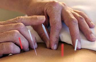 Acupuntura Clínica Milenar - Foto 1